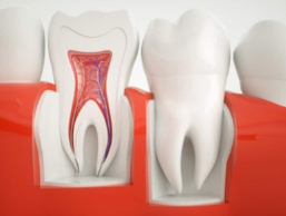 Toothache
